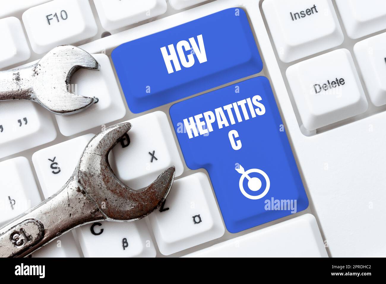 Konzeptionelle Bildunterschrift HCV Hepatitis C. konzeptuelle Foto-Lebererkrankung, die durch ein Virus verursacht wird Schwere chronische Erkrankung -48966 Stockfoto