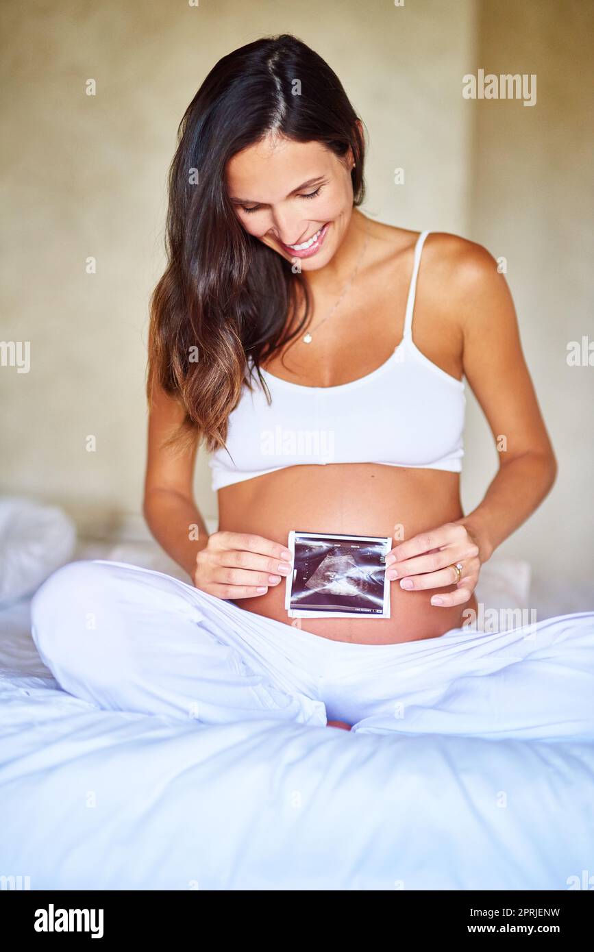 Babys erstes Bild. Eine Schwangere hält ein Sonogramm vor ihrem Bauch. Stockfoto