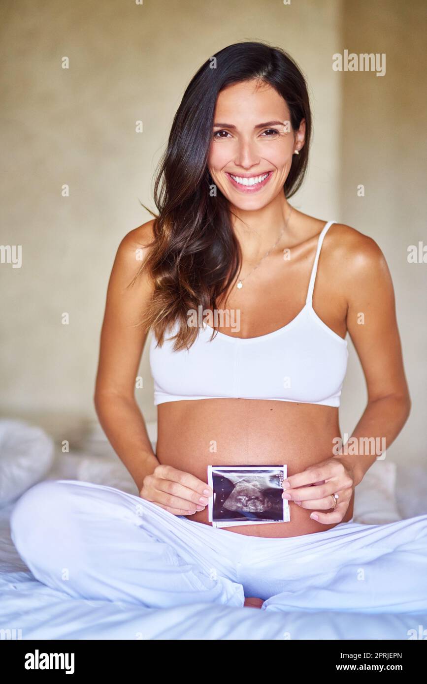 Babys erstes Porträt. Porträtaufnahme einer Schwangeren, die ein Sonogramm vor ihrem Bauch hält. Stockfoto