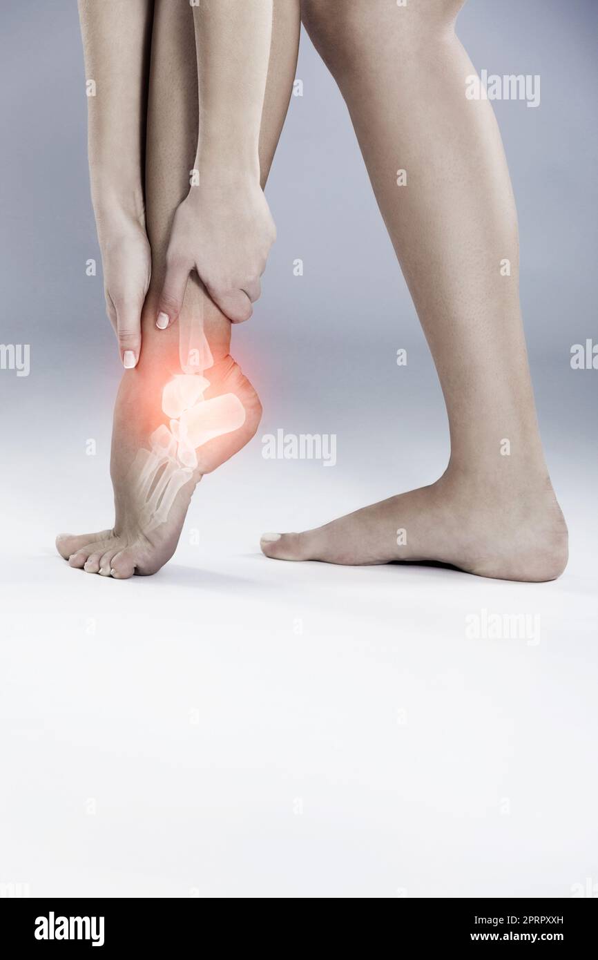 Der Knöchel ist immer eine schmerzhafte Verletzung. Eine Frau, die ihren entzündeten Fuß hält. Stockfoto