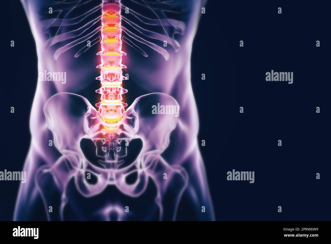Der Schmerz der Entzündung. Eine abgeschnittene Ansicht der Hüfte, Beine und Wirbelsäule isoliert auf einem blauen Hintergrund. Stockfoto