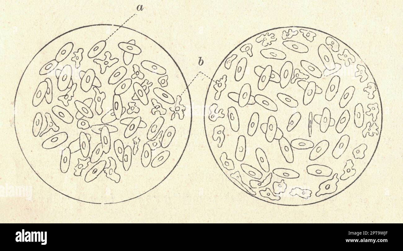 Antikes eingraviertes Bild des Froschblutes. Eine alte Illustration des Froschblutes. Legende: A - rote Blutkörperchen, B - weiße Blutkörperchen. Altes Bild Stockfoto