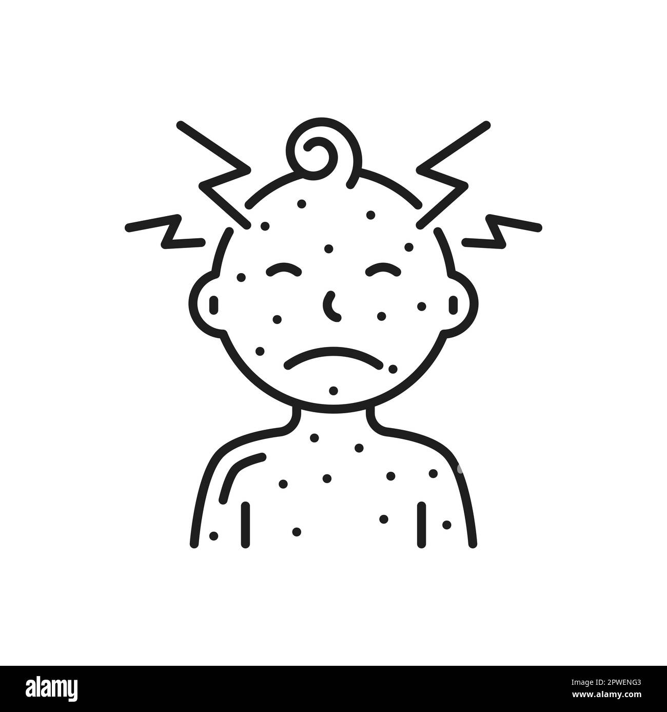 Baby Junge mit Windpocken und Kopfschmerzen, Hautausschlag, Nesselsucht, Reizung Masern. Vektornahrung, medikamentöse allergische Reaktion, Hauterkrankungen, juckende Ausschläge Stock Vektor