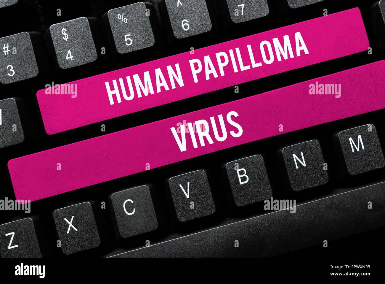 Konzeptionelle Anzeige Human Papilloma Virus, Geschäftsansatz am häufigsten sexuell übertragbare Infektionskrankheit Stockfoto
