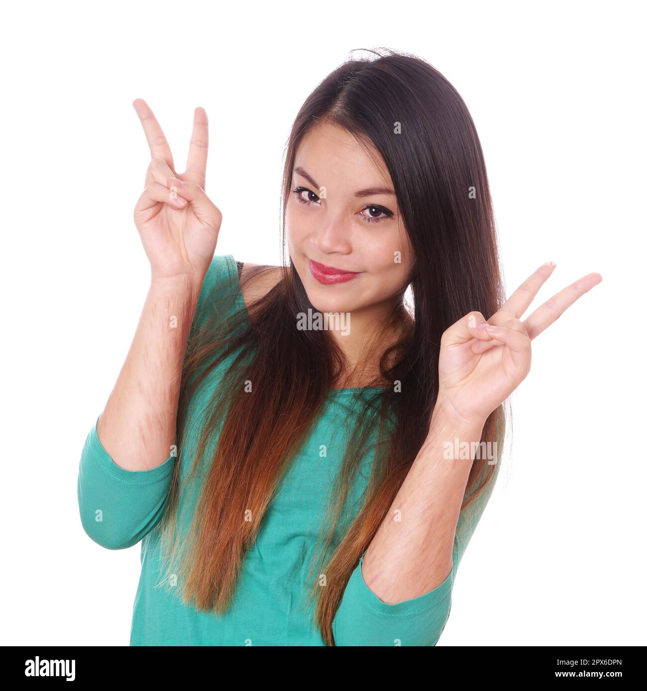 Junge asiatische Frau mit Narben von absichtlicher Selbstverletzung, die ein Siegeszeichen macht Stockfoto
