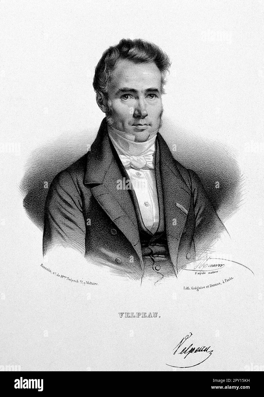 Alfred-Armand-Louis-Marie Velpeau, 1795 – 1867, war ein französischer Anatomist und Chirurg, ein alter Lithograph von Nicolas Eustache Maurin 1800er Stockfoto
