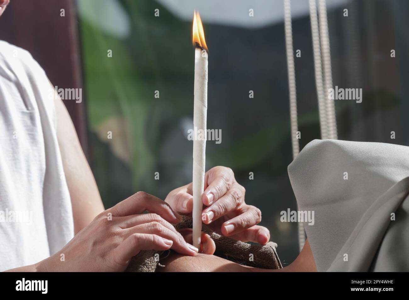 Frau, die im Spa eine Kerzenbehandlung bekommt. Ohrkegel oder thermisch-aurikuläre Therapie. Stockfoto