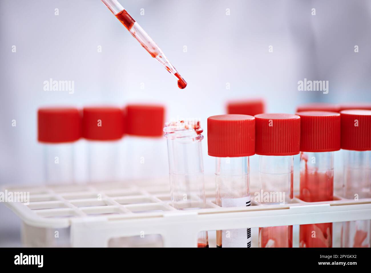 Zeit, dein Blut zu analysieren. Ein Wissenschaftler, der mit Blutproben im Labor arbeitet. Stockfoto