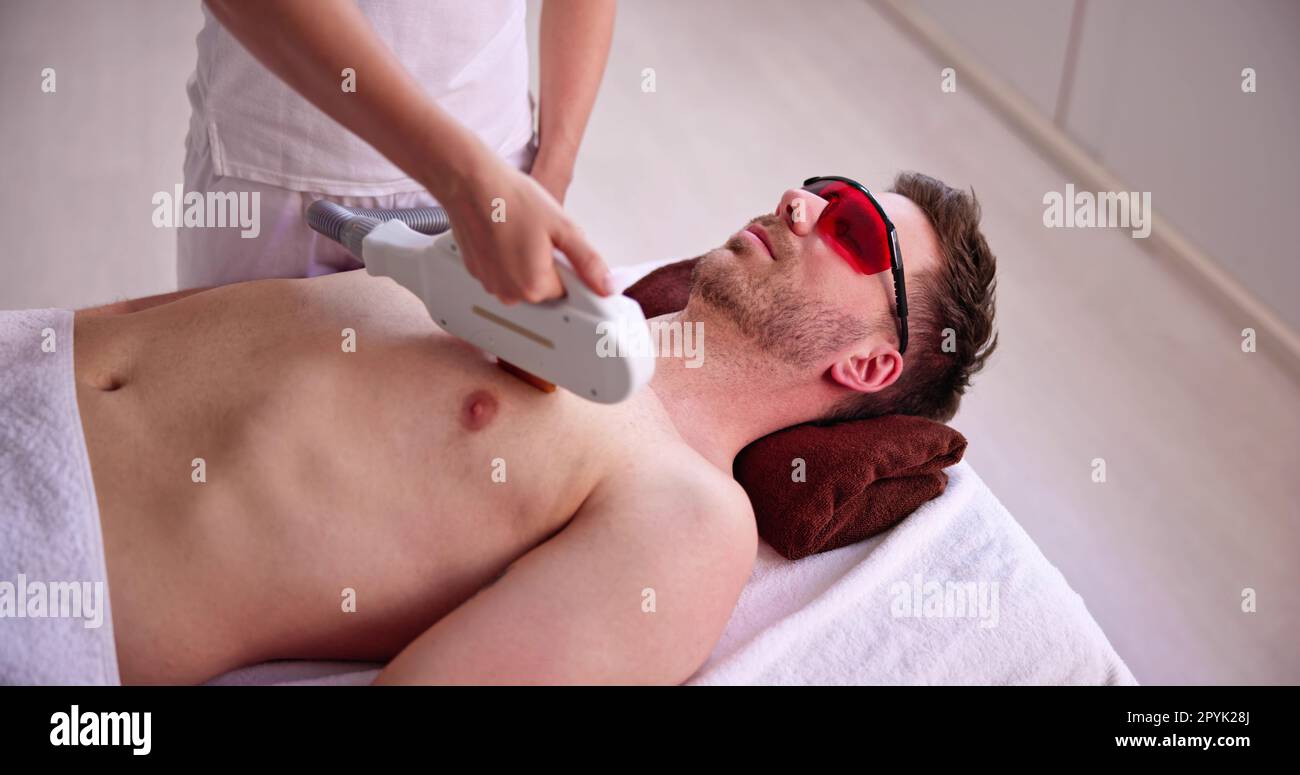 Man Laser Haarentfernung Stockfoto