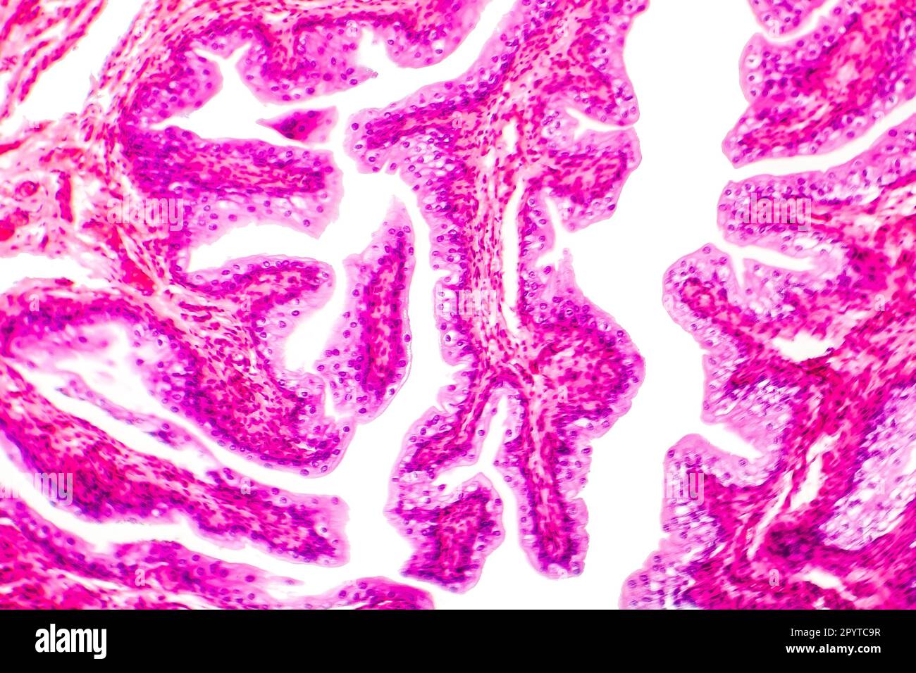 Ubergangsepithelgewebe der Harnblase unter Mikroskop, Lichtmikroskop, Hämatoxylin-Eosin-Färbung Stockfoto
