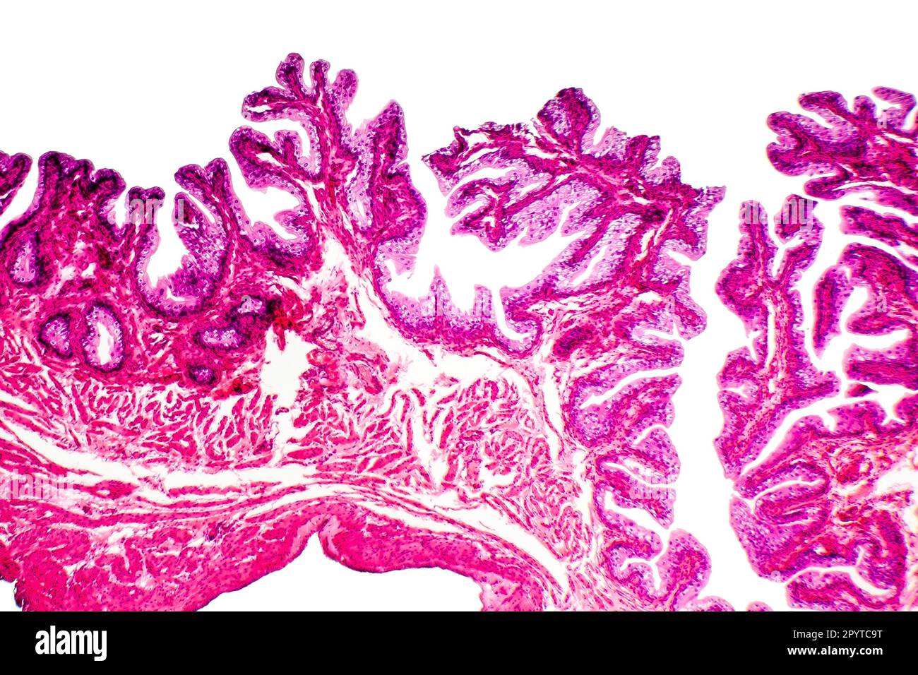 Ubergangsepithelgewebe der Harnblase unter Mikroskop, Lichtmikroskop, Hämatoxylin-Eosin-Färbung Stockfoto