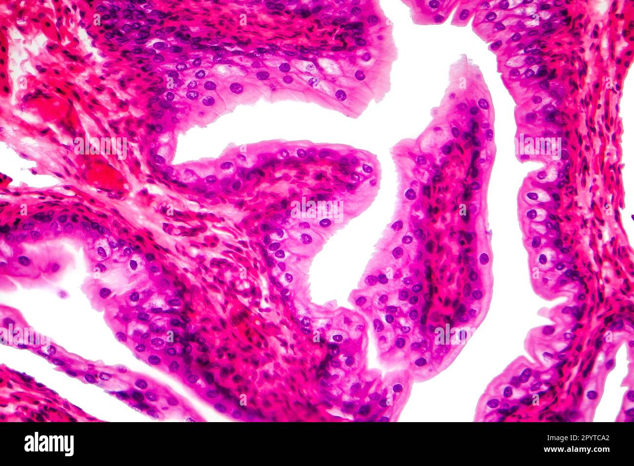 Ubergangsepithelgewebe der Harnblase unter Mikroskop, Lichtmikroskop, Hämatoxylin-Eosin-Färbung Stockfoto