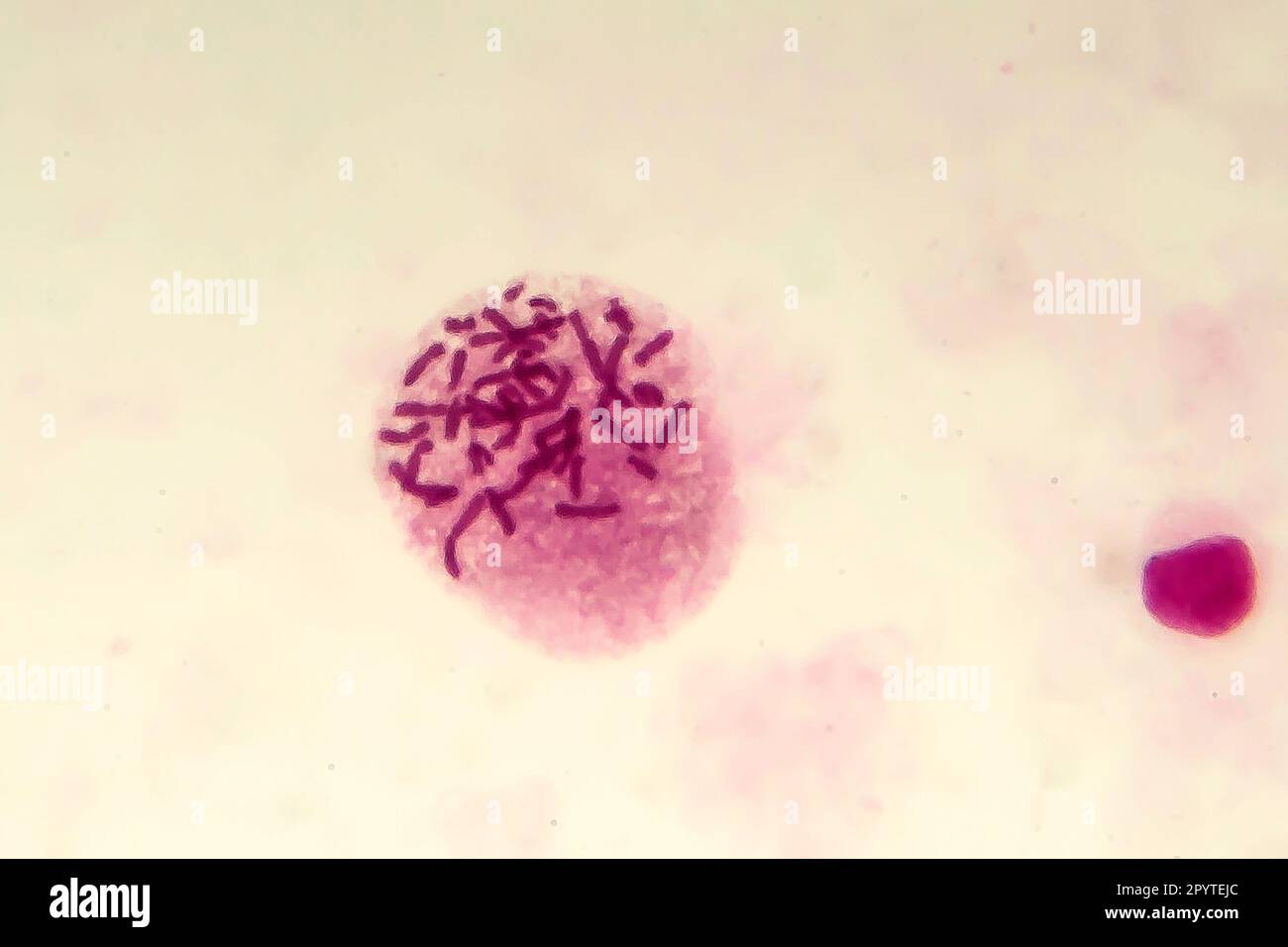 Weibliche Chromosomen in der Zelle, Lichtmikrograph Stockfoto