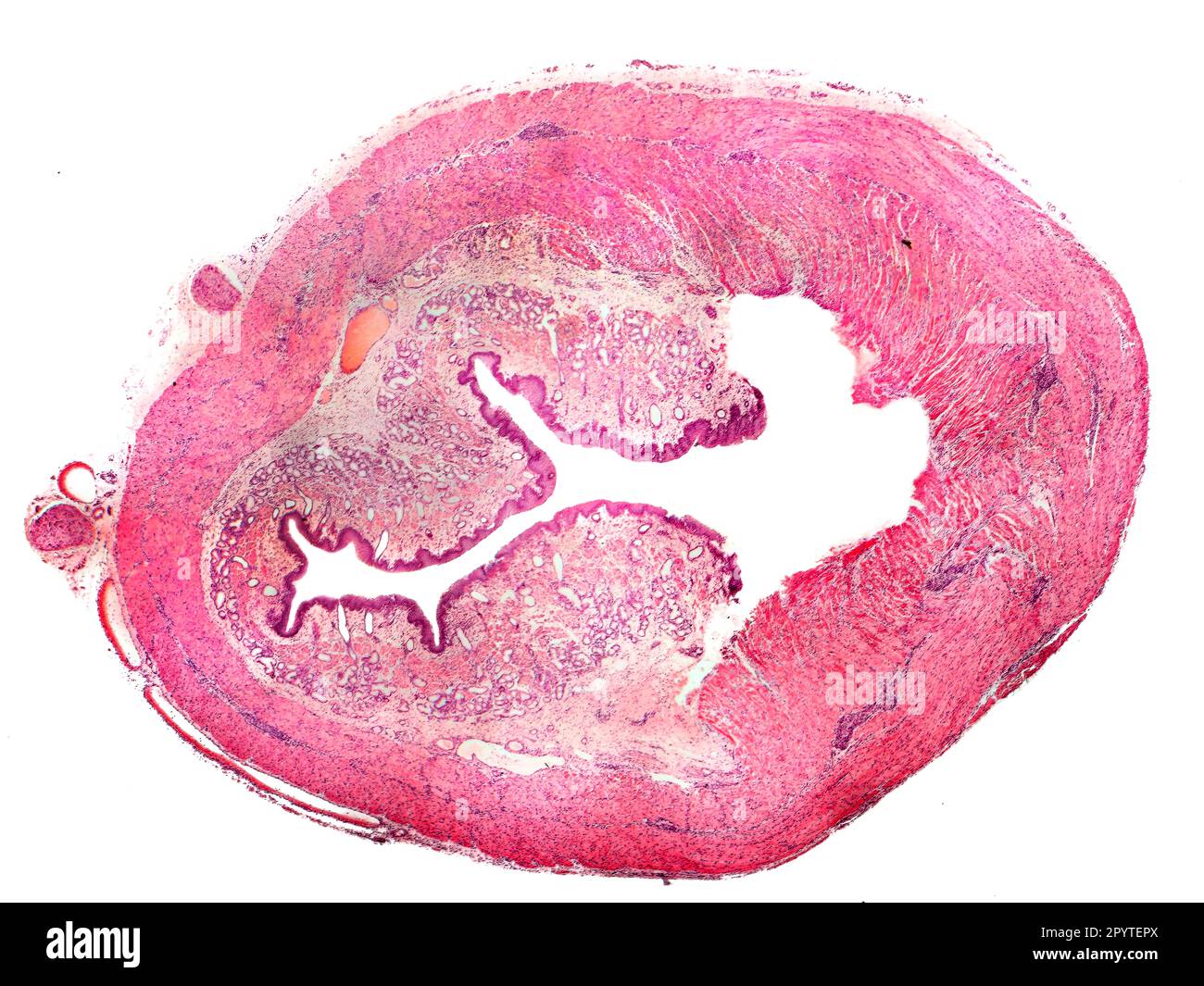 Querschnitt des menschlichen Osophagus, isoliert auf weißem Hintergrund. Lichtmikrograph Stockfoto