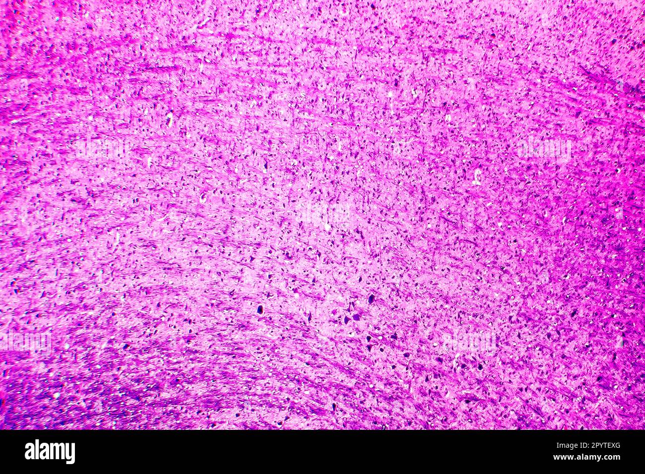 Das Licht der menschlichen Medulla oblongata oder Myelencephalon Stockfoto