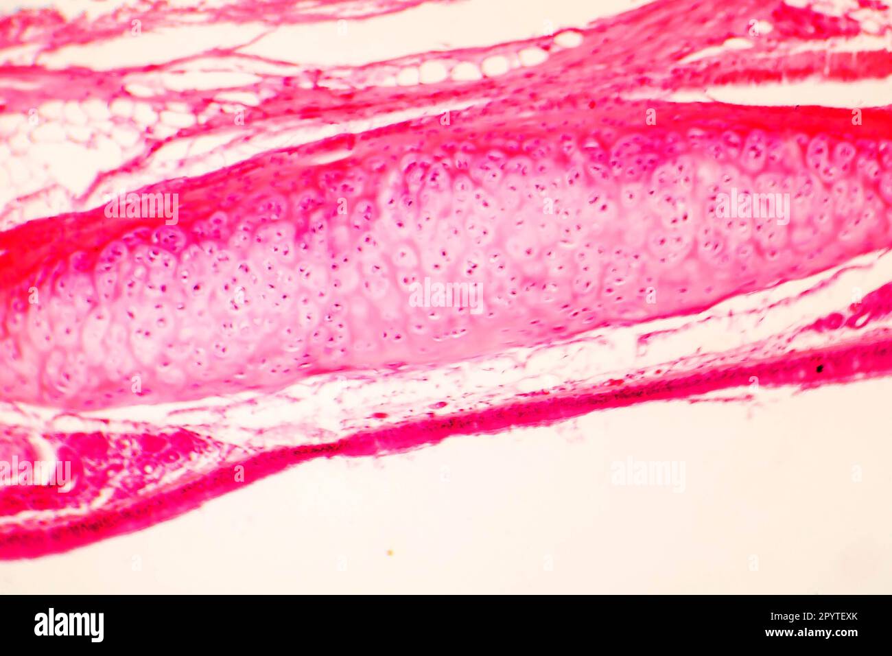 Hyaliner Knorpel der menschlichen Trachea, Lichtmikrograph Stockfoto