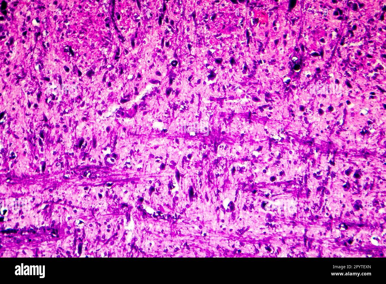 Das Licht der menschlichen Medulla oblongata oder Myelencephalon Stockfoto