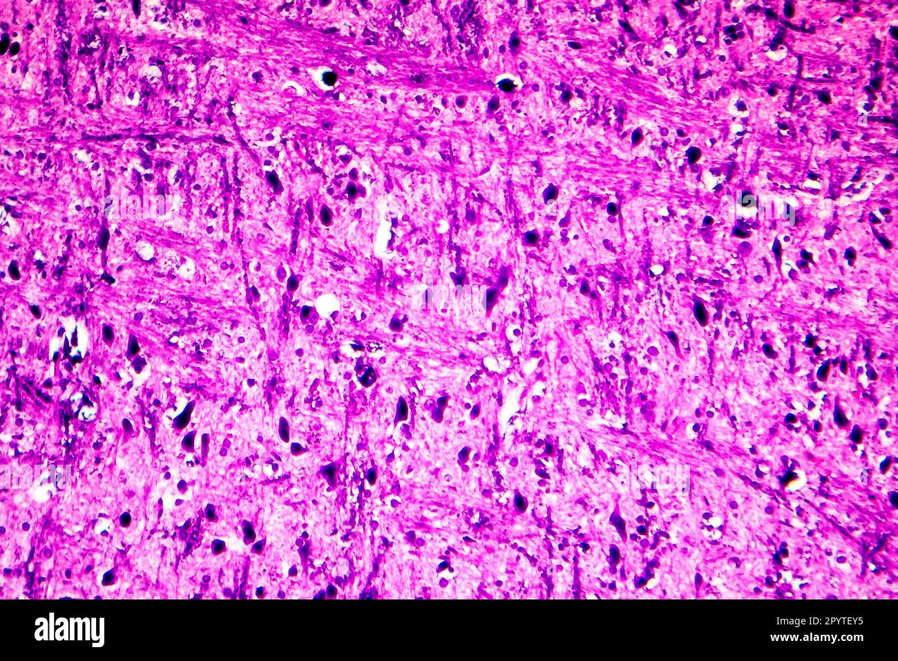 Das Licht der menschlichen Medulla oblongata oder Myelencephalon Stockfoto