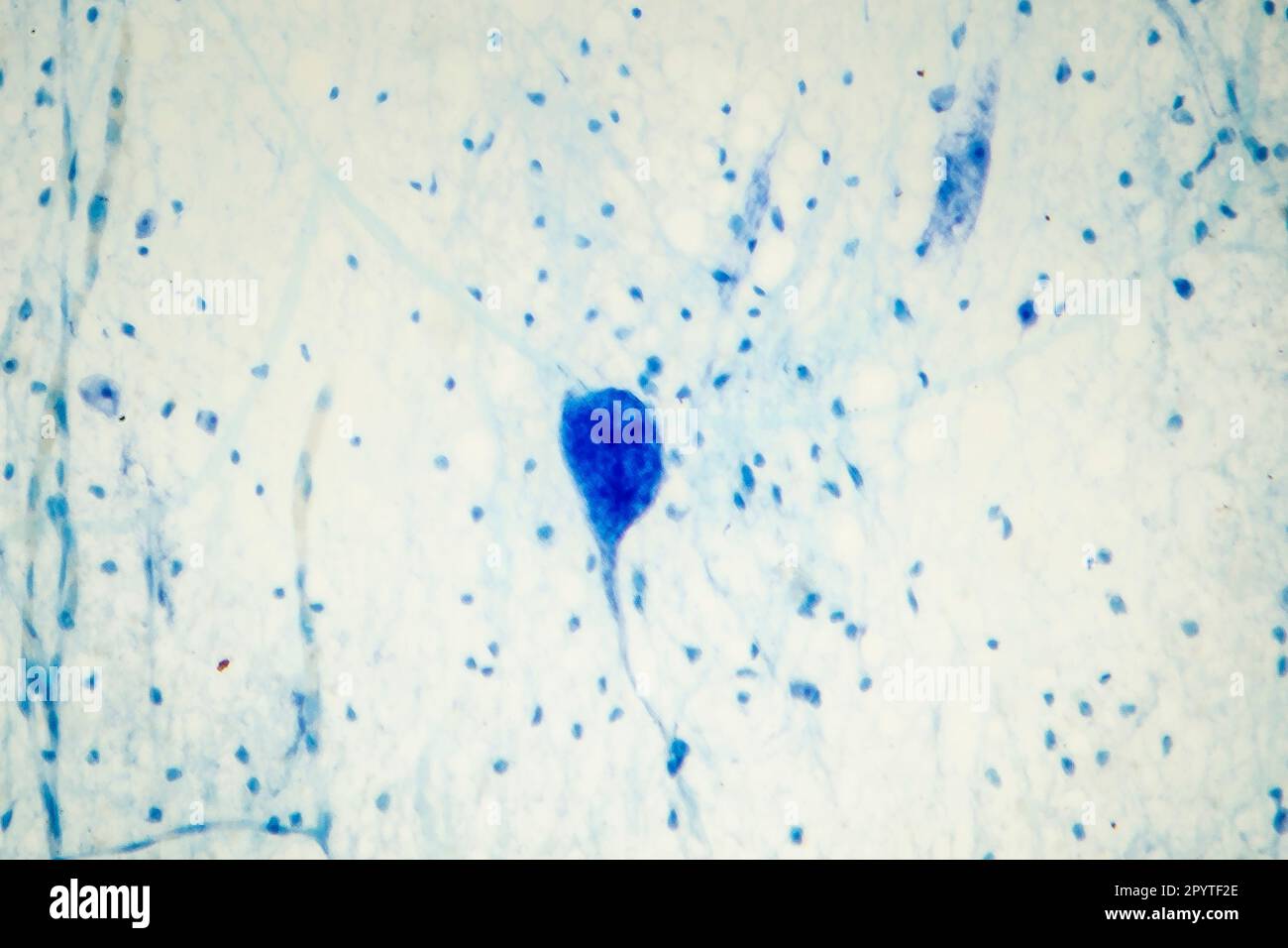 Lichtmikrographische Darstellung menschlicher Hirngewebe mit Neuronen und Gliazellen Stockfoto