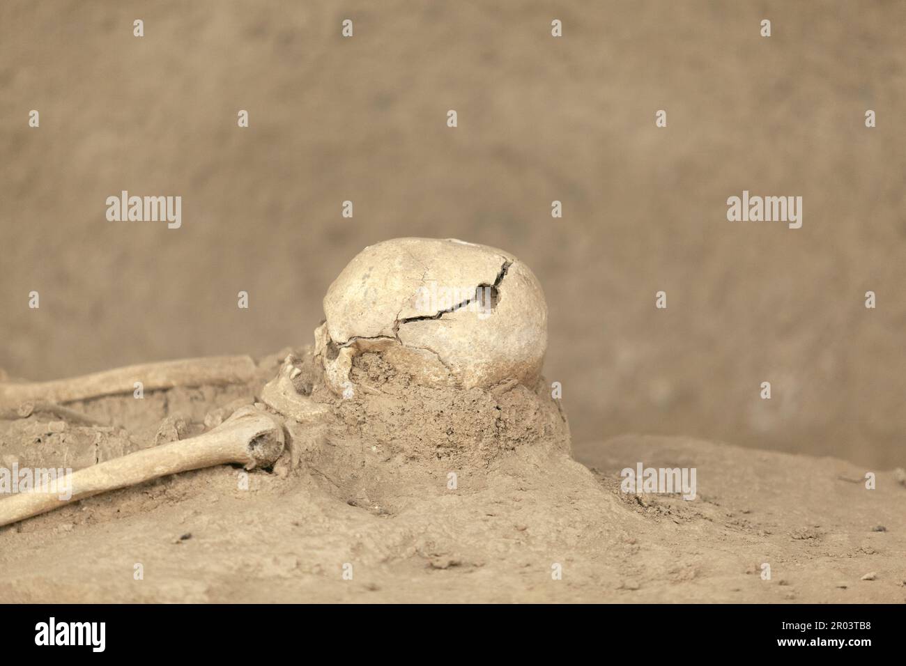 Römisches Skelett mit trepaniertem chirurgischen Eingriff-Schädelgrat Stockfoto