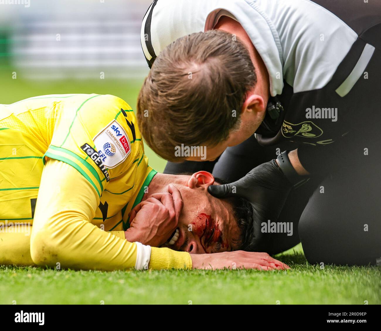 Norwich, Großbritannien. 08. Mai 2023. *** GRAFIKINHALT*** Dimitris Giannoulis #30 aus Norwich City erhält beim Sky Bet Championship-Spiel Norwich City gegen Blackpool in der Carrow Road, Norwich, Großbritannien, am 8. Mai 2023 (Foto von Mark Cosgrove/News Images) in Norwich, Großbritannien, am 5./8. Mai 2023 einen schlechten Schnitt auf die Wange. (Foto: Mark Cosgrove/News Images/Sipa USA) Guthaben: SIPA USA/Alamy Live News Stockfoto