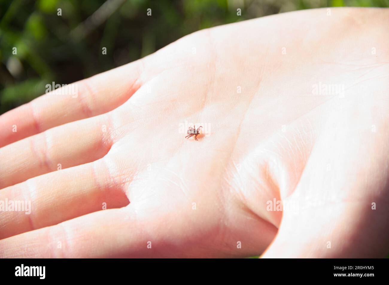 Zecken kriechen auf Menschenhand. Ixodes-ricinus-verbreitende Zeckenenzephalitis und Borreliose. Gefährlicher menschlicher Parasit. Stockfoto