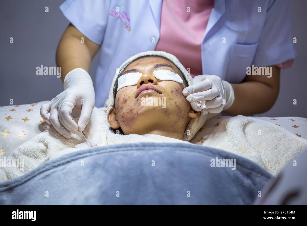 Junge Frau, die Pickel in der Klinik presst. Probleme, die Frauen wegen Hautentzündungen befürchten. Die Schönheit der Frau. Stockfoto