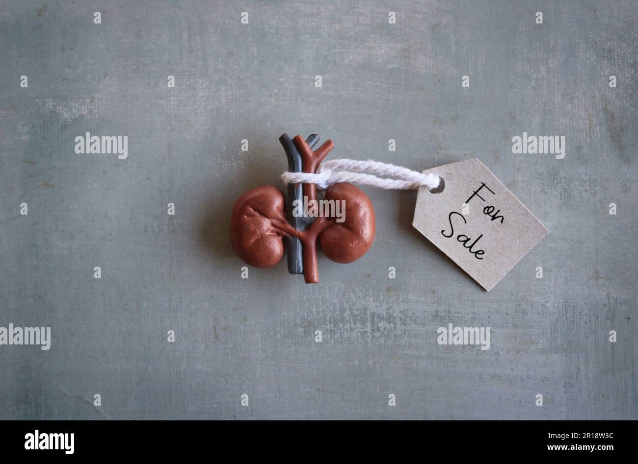 Menschliche Niere mit Verkaufsmarke. Organhandel, Organtransplantation und illegaler Organhandel Stockfoto