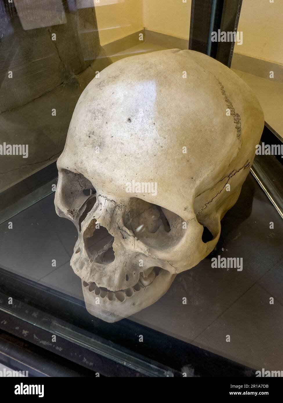 Ein menschlicher Schädel im Archäologischen Museum von Calingasta in Calingasta, San Juan, Argentinien. Stockfoto
