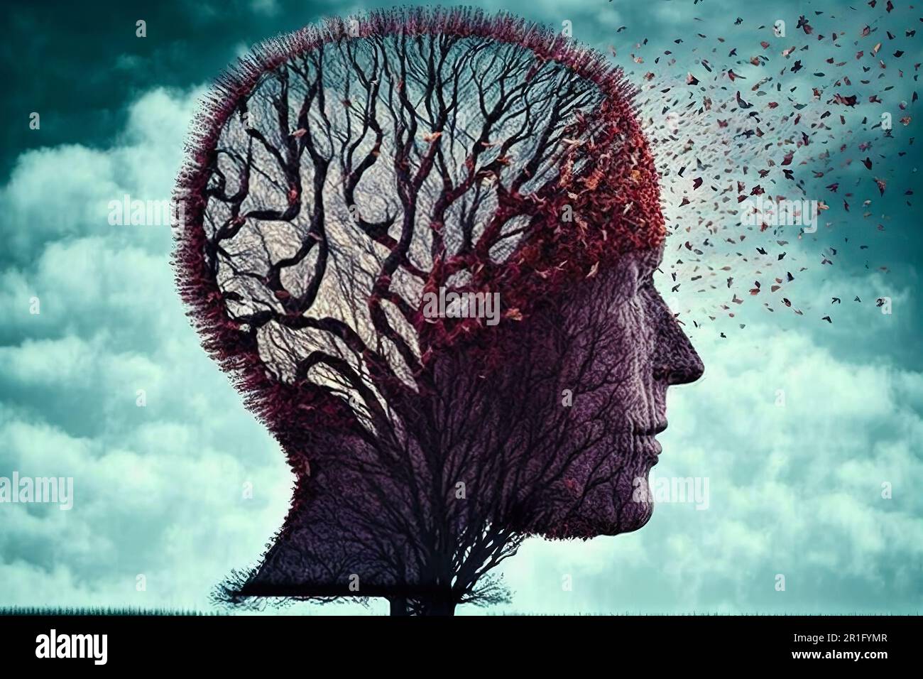 Die Alzheimer-Krankheit, auch als Alzheimer-Demenz bekannt, ist die