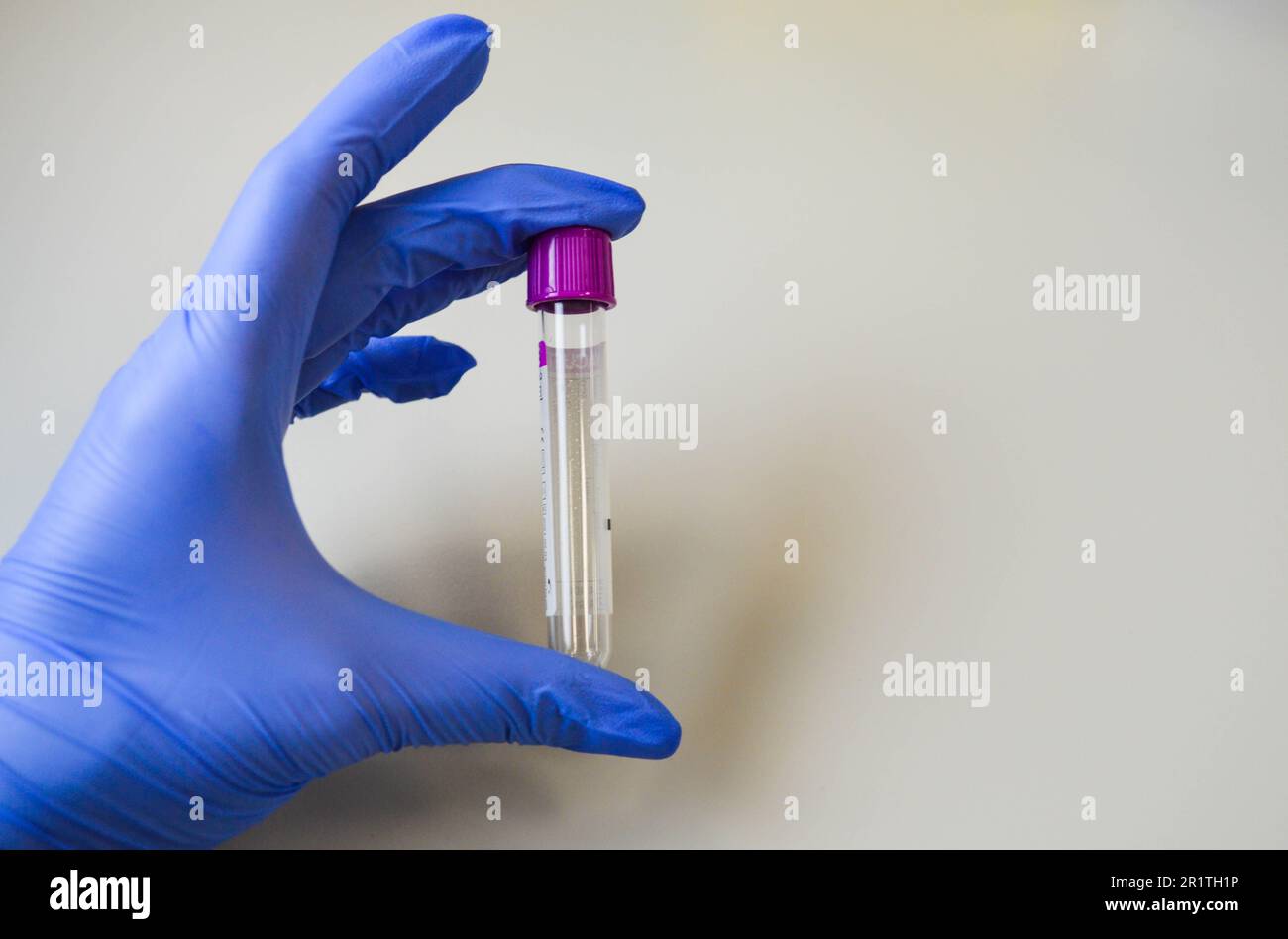 Arzt mit Handschuhen hält Impfstoff gegen Coronavirus. Stockfoto