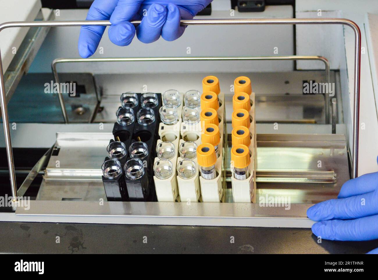 Blutforschung, Wissenschaftlerin Hand halten Teströhrchen mit Blut im Labor. Stockfoto