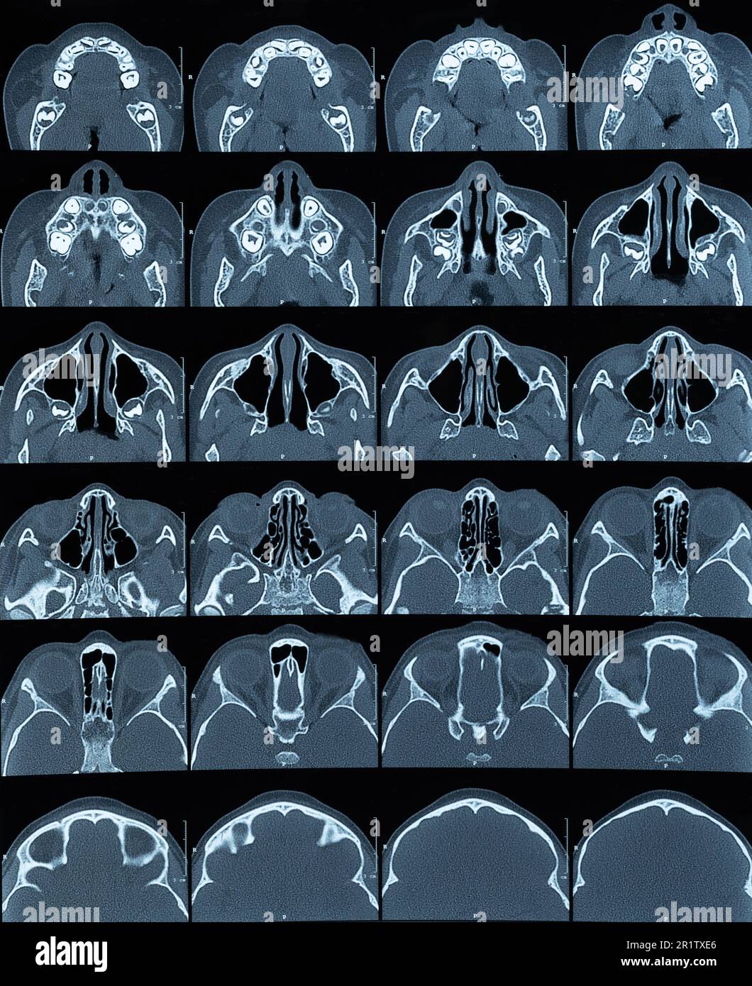 MRT-Scan des Kopfbildes in verschiedenen Ebenen. 3D Röntgenbild des Gehirns Stockfoto