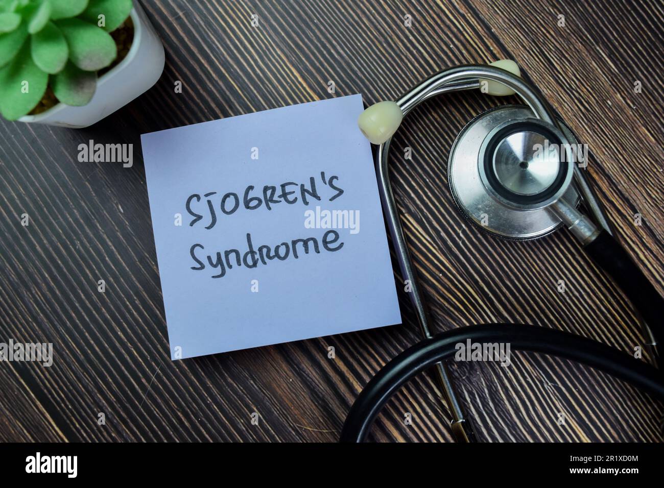 Konzept des Sjögren-Syndroms Schreiben auf Haftnotizen mit Stethoskop isoliert auf Holztisch. Stockfoto