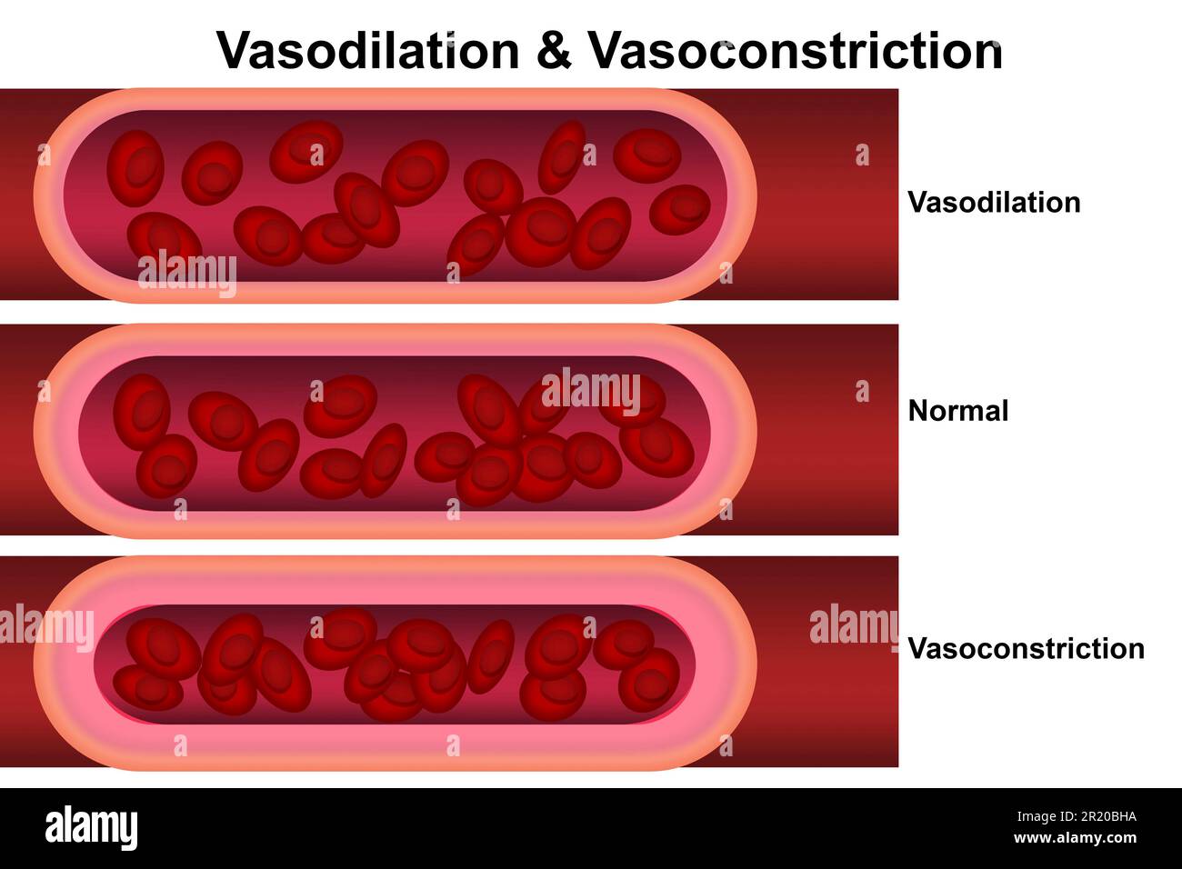 Vasodilatation und Vasokonstriktion. Gefässvergleich, 3D-Rendering Stockfoto