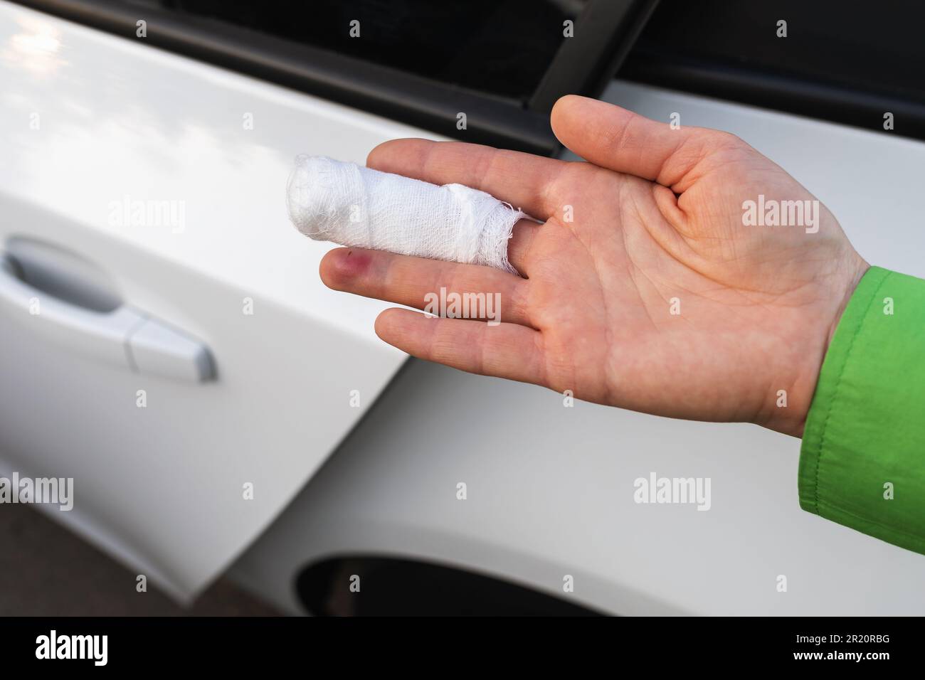 Ein Mann zeigt eine Hand mit einem bandagierten Finger vor dem Hintergrund einer offenen Autotür, ein Konzept zum Thema Verletzung durch Fahrlässigkeit, gequetscht seine Hand Stockfoto