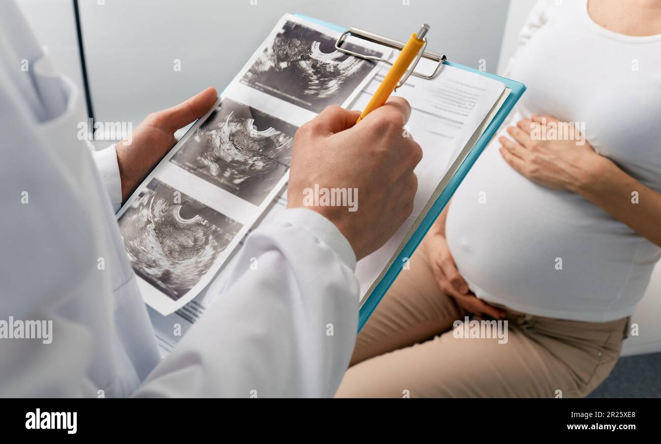 Besuch beim Gynäkologen der Geburtshilfe durch eine Schwangere zur geplanten Untersuchung. Schwangerschaftsberaterin Stockfoto