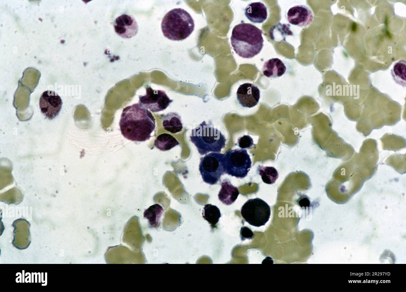 Mikroskopisches Bild teilender Blutzellen Stockfoto