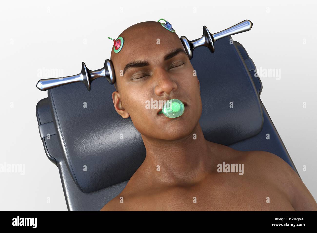 Elektrokrampftherapie, Illustration Stockfoto