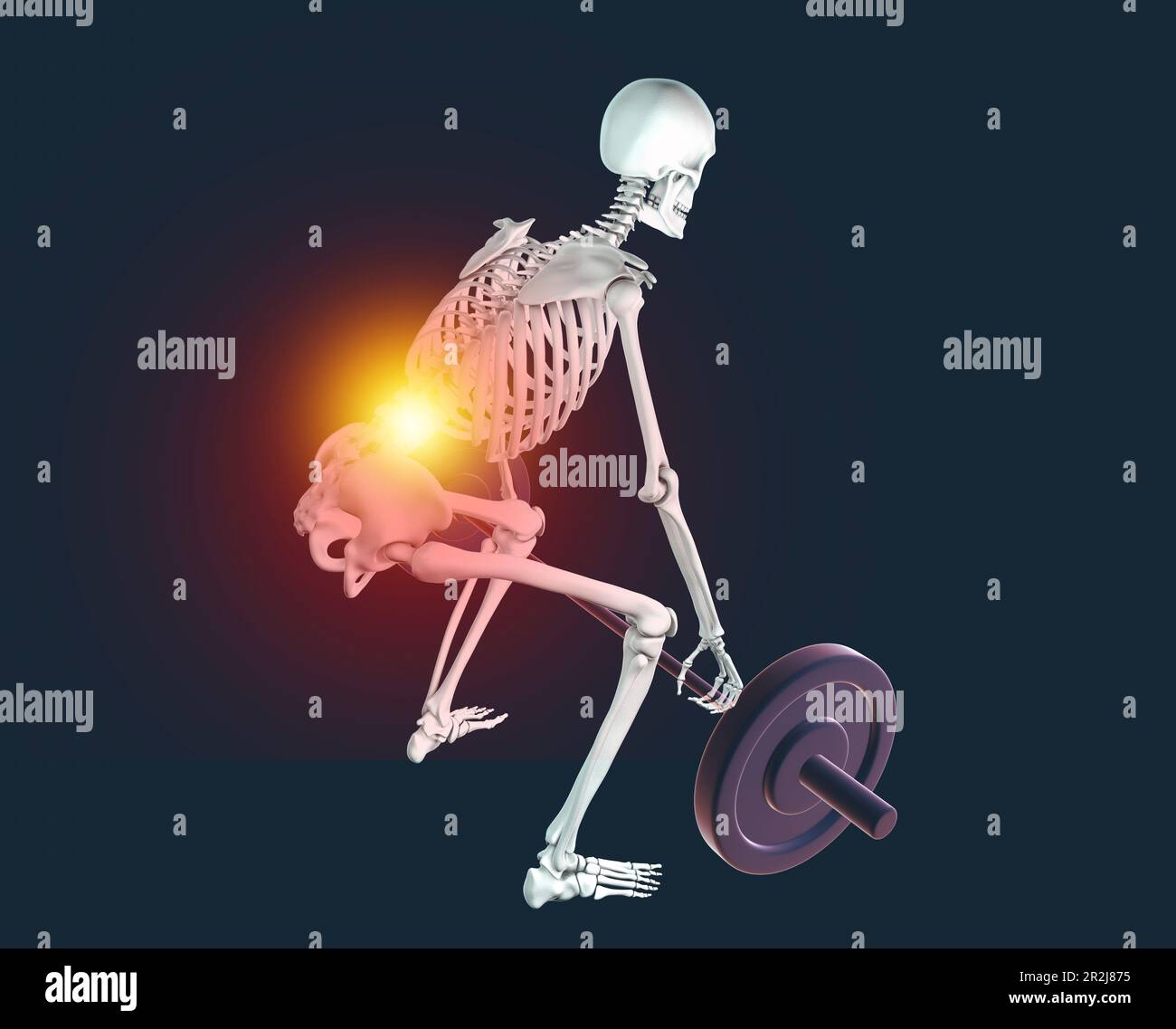 Ein Skelett mit Rückenschmerzen, das eine Hantel hebt, Illustration Stockfoto