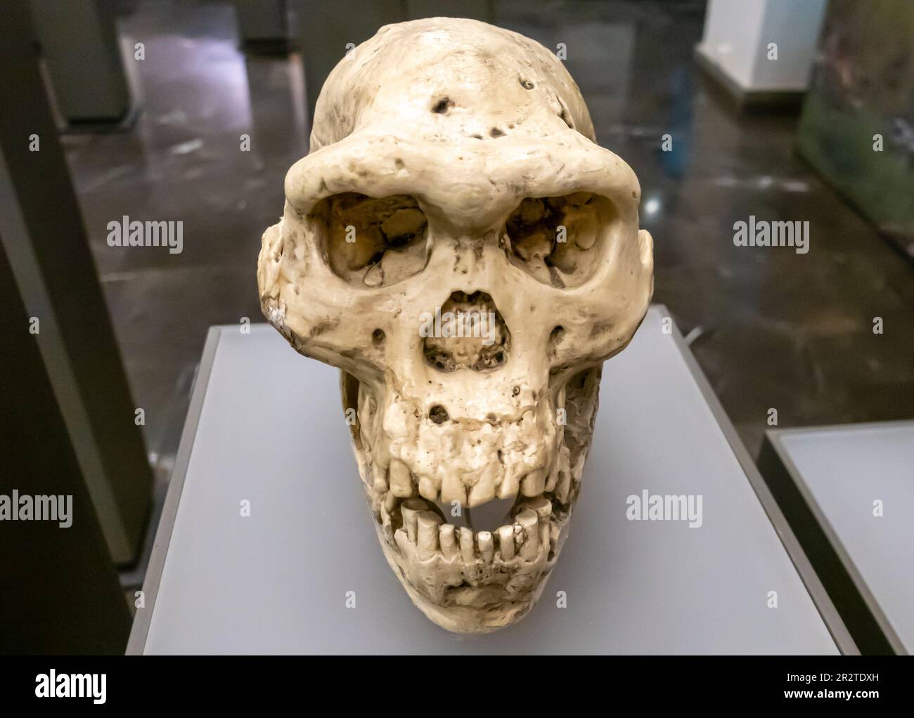 Homo erectus Schädel, Homo erectus cranium, Unterkiefer D4500 - D2600, 1,77 Millionen Jahre, Dmanisi Georgia Stockfoto