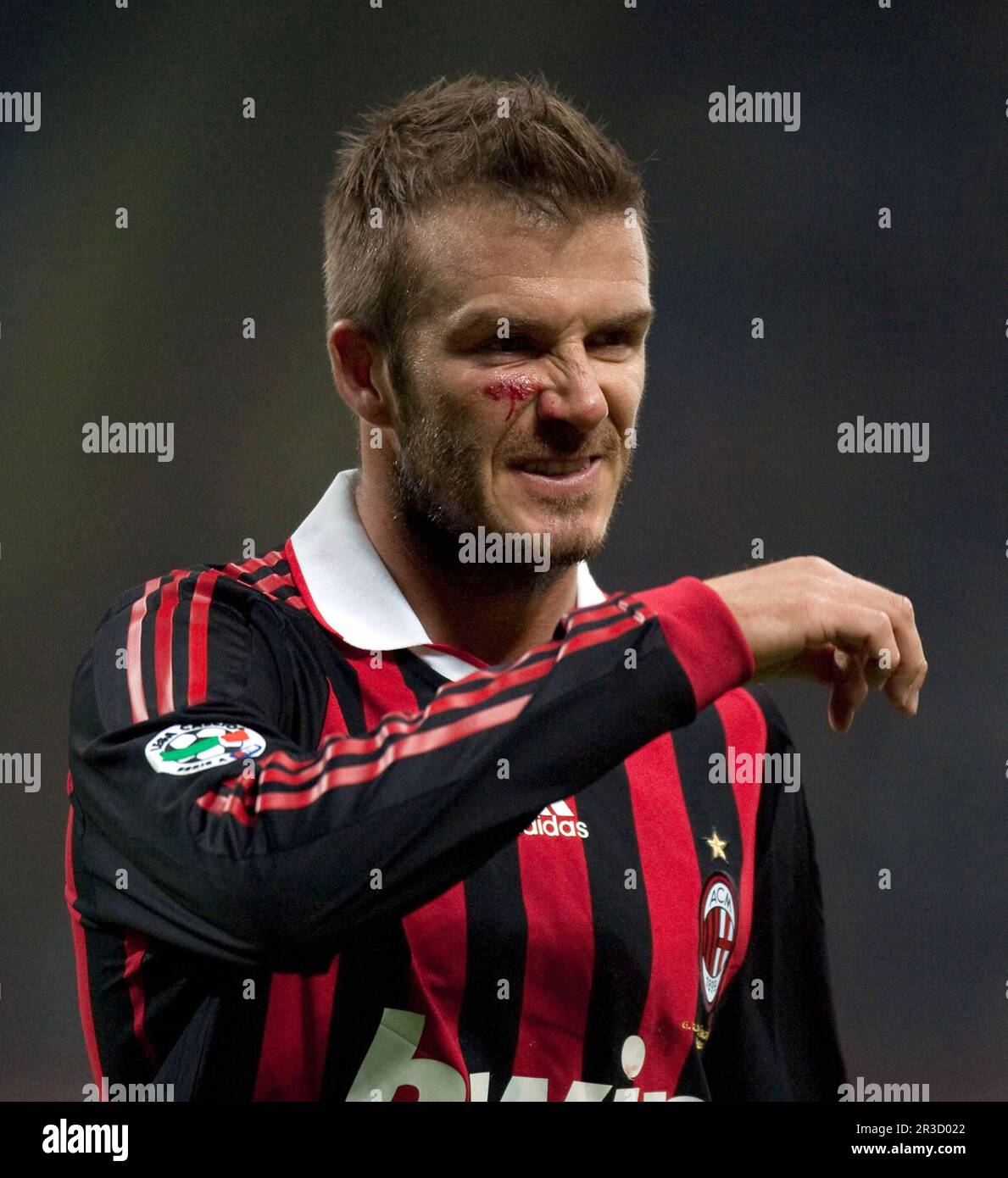 Mailand AC Mailand gegen Chievo (1-0) Serie A 14/03/2010David Beckham (Mailand) bekommt einen tritt ins Gesicht und muss während des Sieges behandelt werden Stockfoto