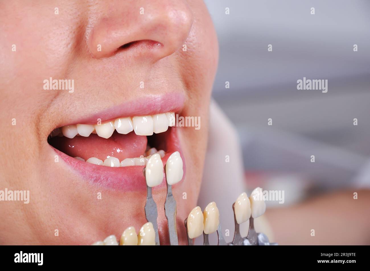schattieren Sie Entschlossenheit Zahn mit Hilfe von Schatten Führer, Nahaufnahme Stockfoto