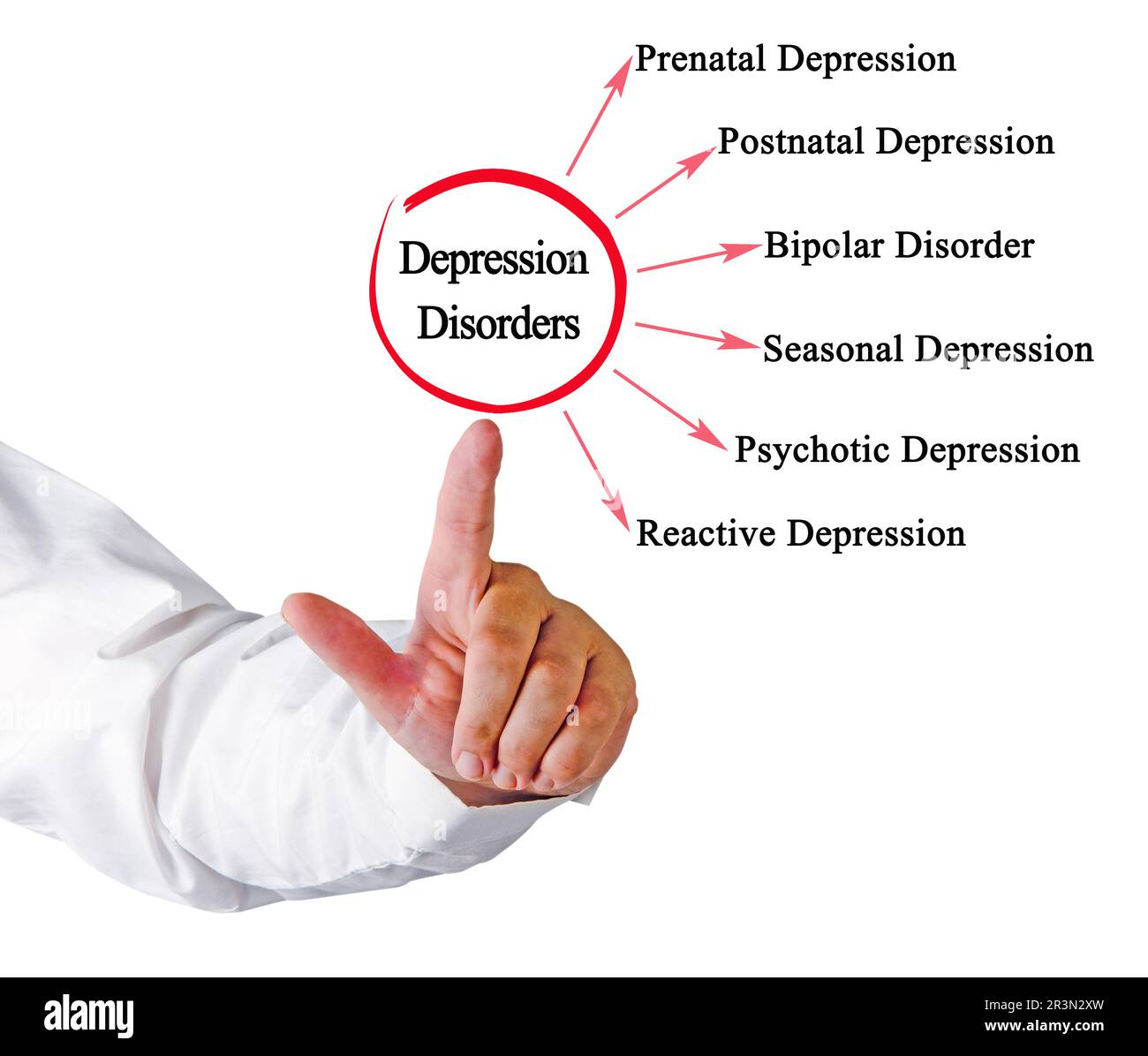 Sechs Arten von Depressionsstörungen Stockfoto