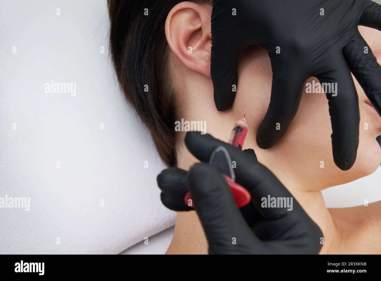 Schöne Frau bekommt eine Spritze in ihr Gesicht Stockfoto