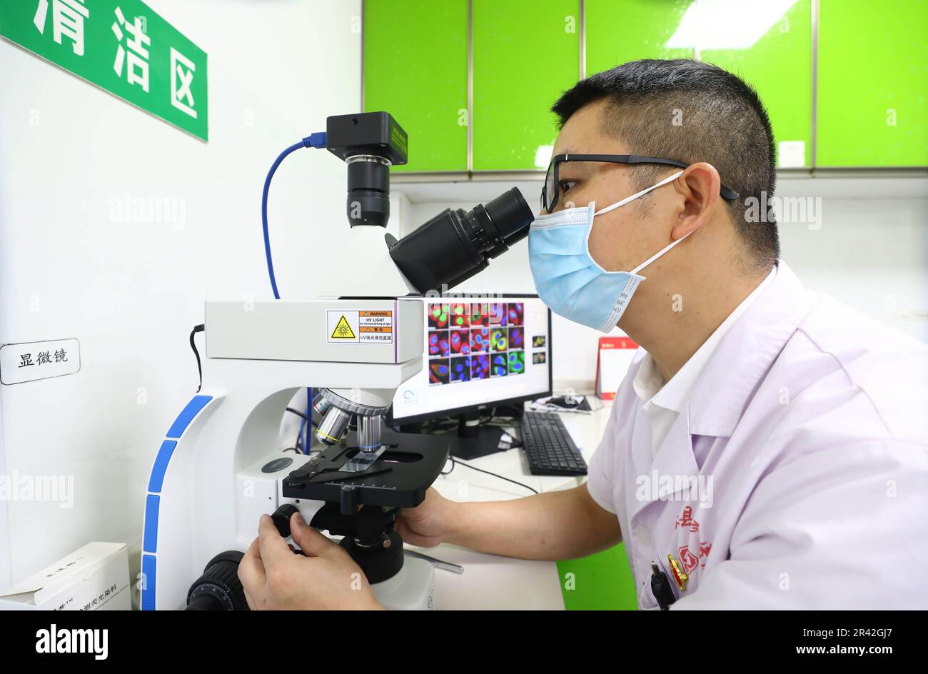 LIUZHOU, CHINA - 25. MAI 2023 - Ein Arzt führt eine Pilzabstrich-Untersuchung an der Dermatologie-Abteilung des Volkskrankenhauses in Liuzhou, Guangx durch Stockfoto