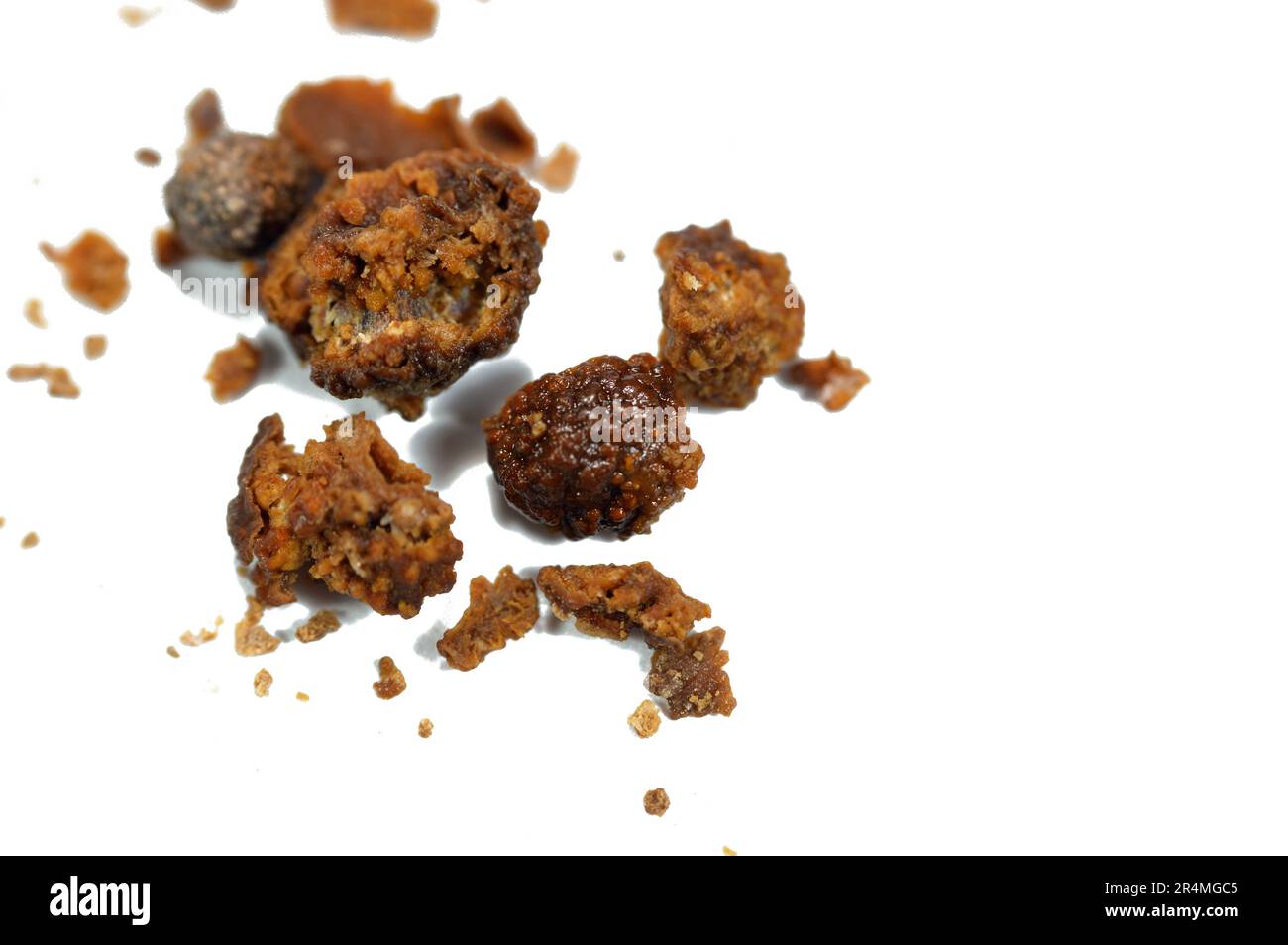 Nephrolithiasis, unregelmäßige braune Nierensteine (Nierenstein oder Nephrolith), die Steine sind nach operativer Ureteroskopie und Laser unterschiedlich groß Stockfoto