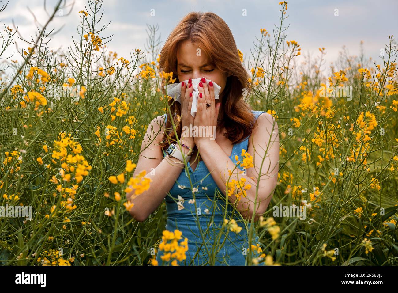 Das Mädchen reagiert allergisch auf die Pollen gelber Rapsblüten auf dem Feld Stockfoto