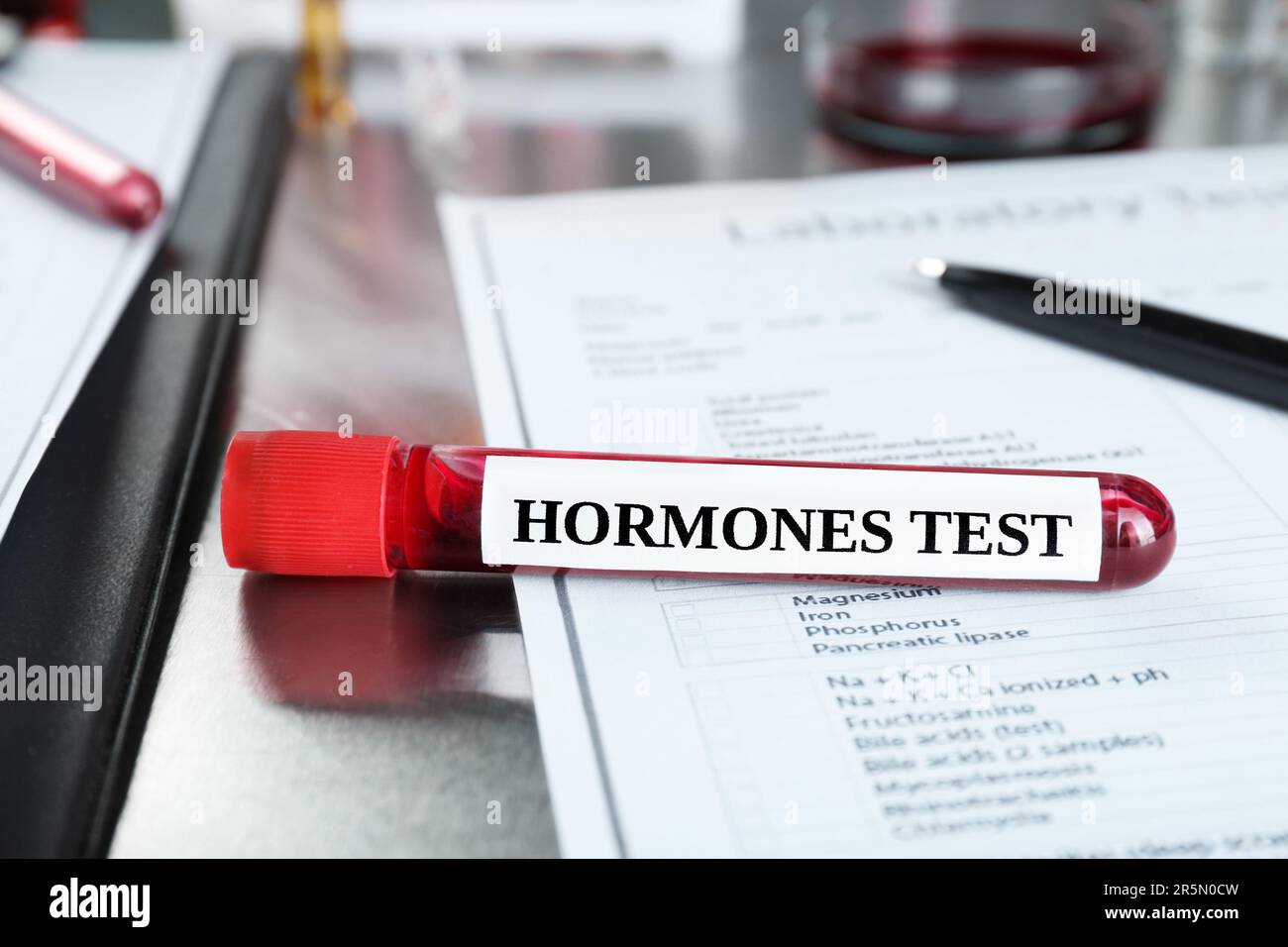Glasröhrchen mit Blutprobe und Etikett Hormone Test auf einem Metalltisch Stockfoto