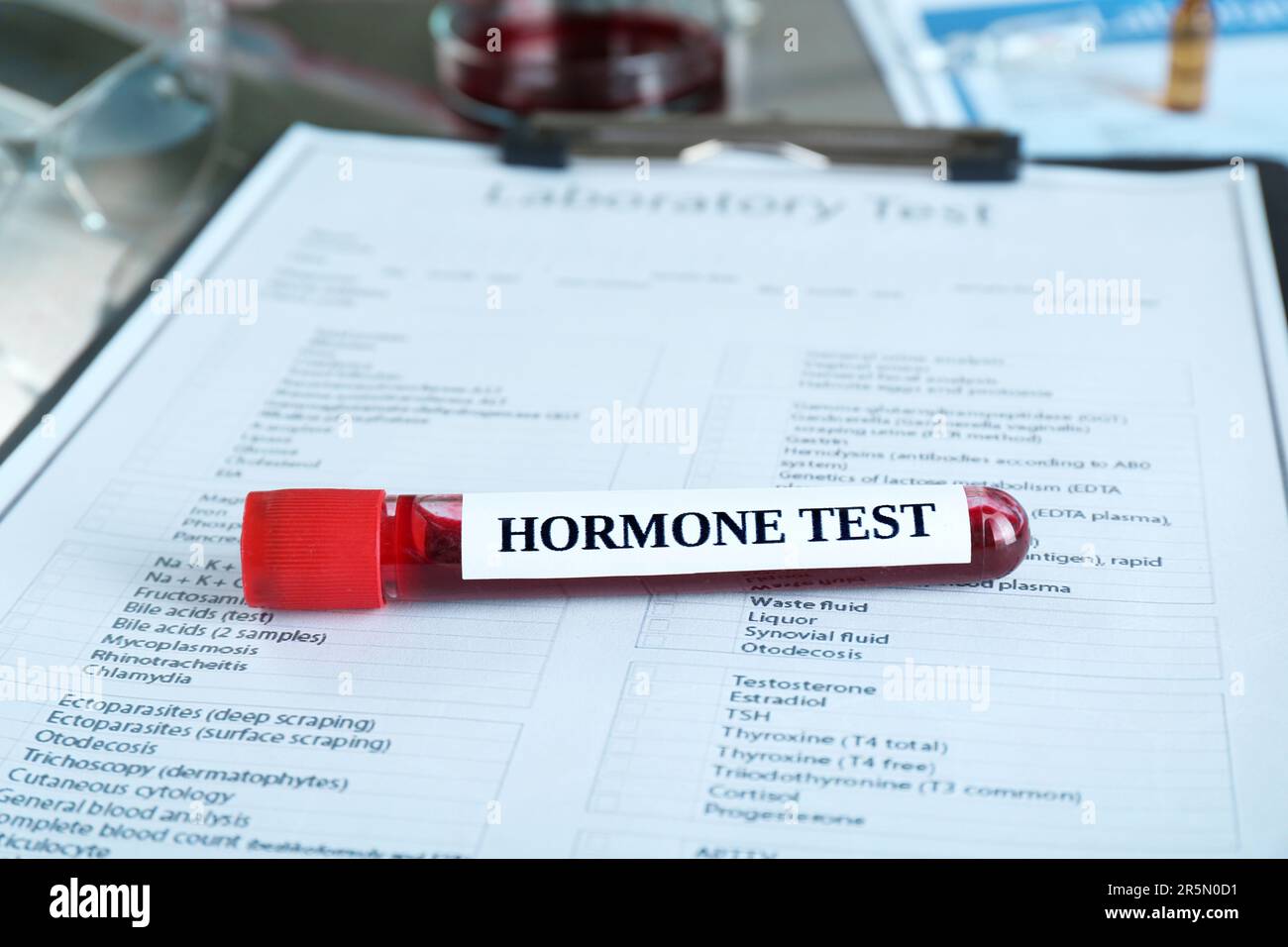 Glasröhrchen mit Blutprobe und Etikett Hormone Test auf dem Klemmbrett Stockfoto